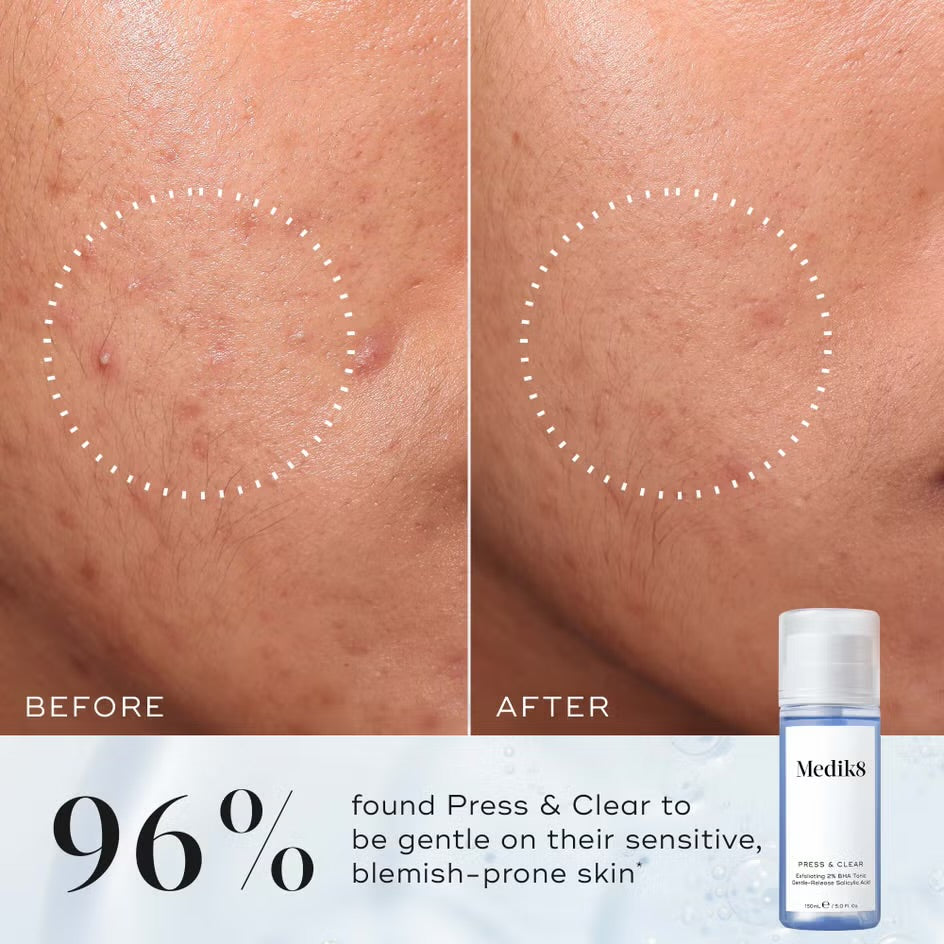Press & clear Toner